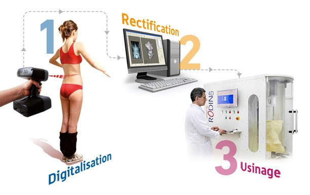 digitalisation prothèse