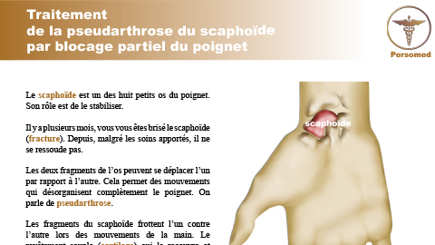 Traitement de la pseudarthrose du scaphoïde par blocage partiel du poignet