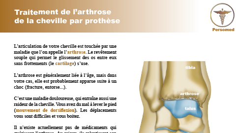 Traitement de l’arthrose de la cheville par prothèse