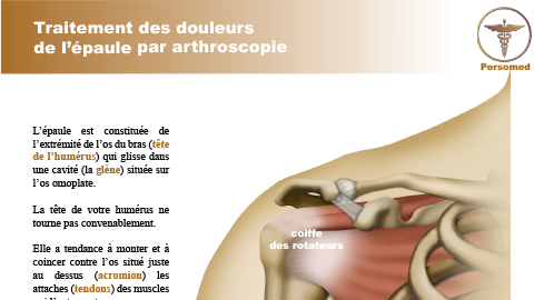 Traitement des douleurs de l’épaule par arthroscopie