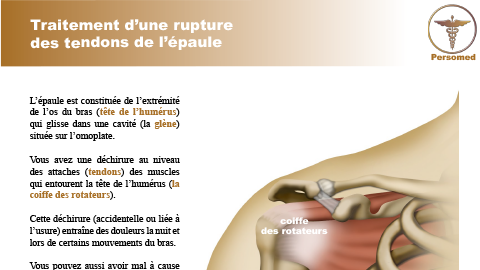 Traitement d’une rupture des tendons de l’épaule