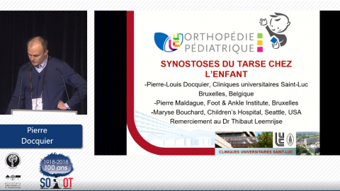 2018 CE Synostoses du tarse (Pierre Docquier)
