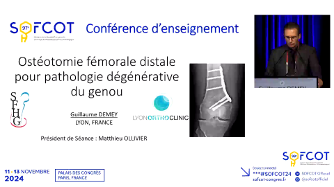 Conférence d'enseignement : Ostéotomie fémorale pour pathologie dégénérative du genou 