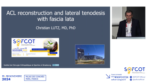 Reconstruction Ligament Croisé Antérieur par Facia Lata sous arthroscopie 