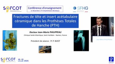 Conférence d'enseignement : CE 06 Fracture des têtes et inserts acétabulaires en céramique dans les PTH