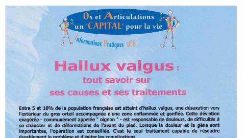 Hallux valgus : tout savoir sur ses causes et ses traitements