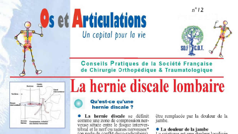 La hernie discale lombaire