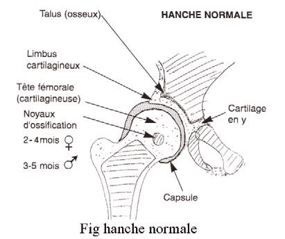 Luxation congenitale de hanche - normal