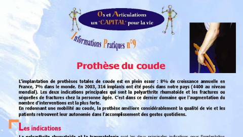 Prothèse du coude