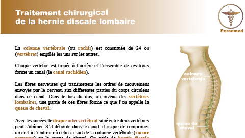 Traitement chirurgical de la hernie discale lombaire