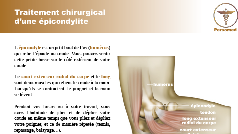 Traitement chirurgical d’une épicondylite