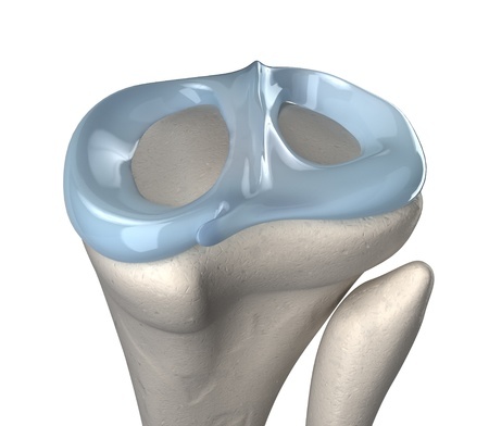 Genou : tout savoir sur la prise en charge des ménisques blessés ...