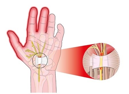 Ligament annulaire