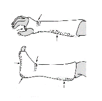 Immobilisation par plâtre des membres ou du rachis. Votre « plâtre ...