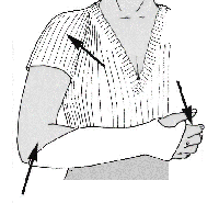 platre exercices physiques