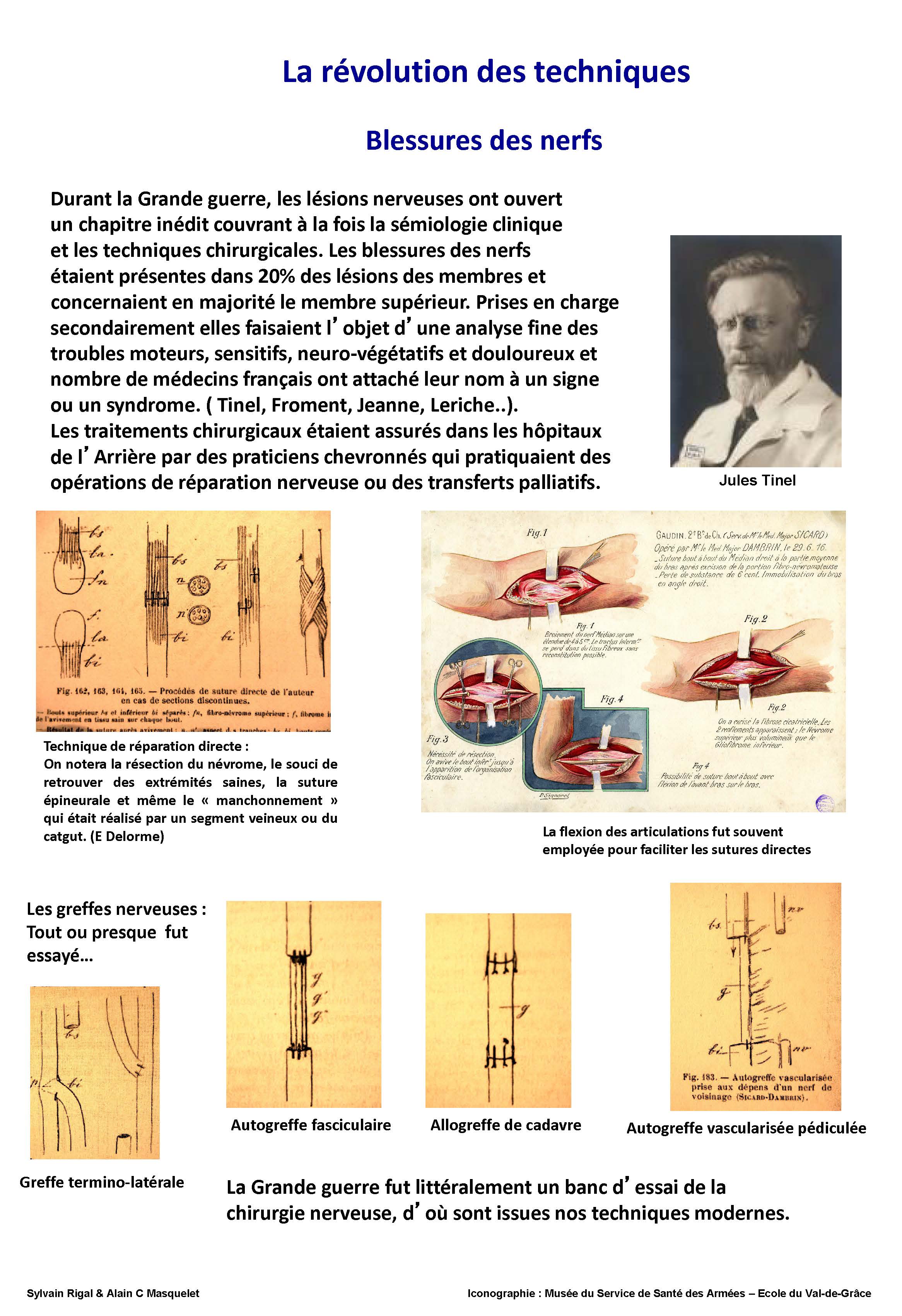 La révolution des techniques. Blessures des nerfs