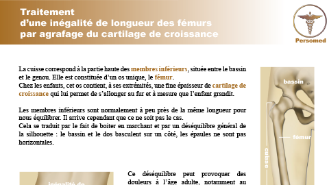 Enfant : Traitement d’une inégalité de longueur des fémurs par agrafage du cartilage de croissance