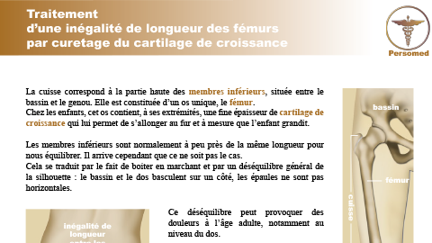 Enfant : Traitement d’une inégalité de longueur des fémurs par curetage du cartilage de croissance