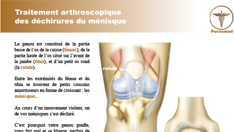 Traitement arthroscopique des déchirures du ménisque