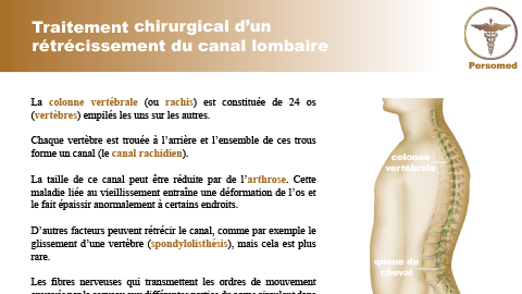 Traitement chirurgical d’un rétrécissement du canal lombaire