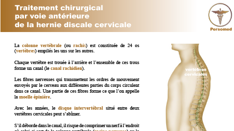 Traitement chirurgical par voie antérieure de la hernie discale cervicale