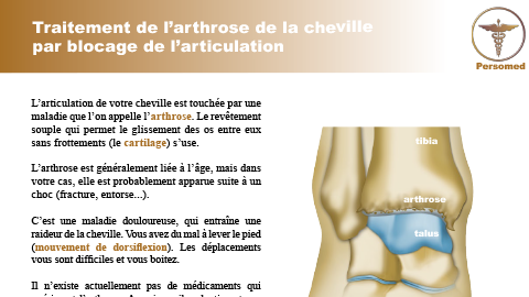 Traitement de l’arthrose de la cheville par blocage de l’articulation