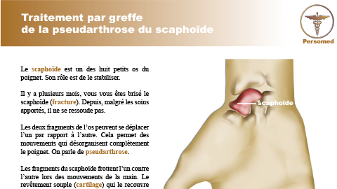 Traitement par greffe de la pseudarthrose du scaphoïde