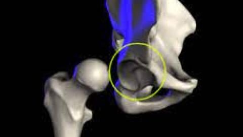 acetabulum