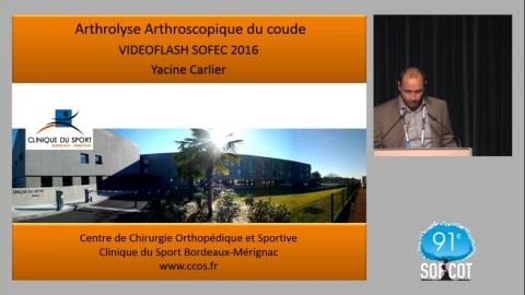 SOFEC- Arthrolyse arthroscopique du coude