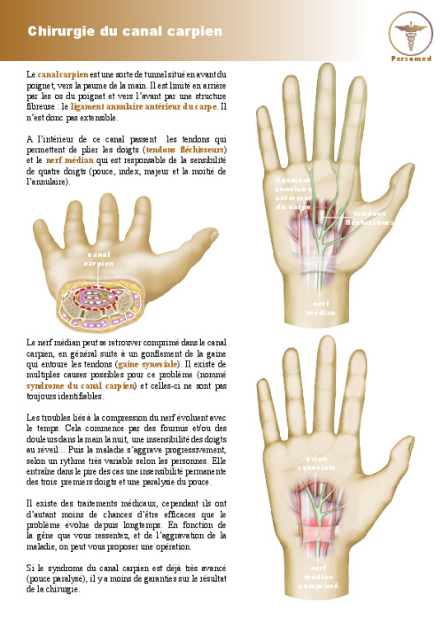 Chirurgie du canal carpien