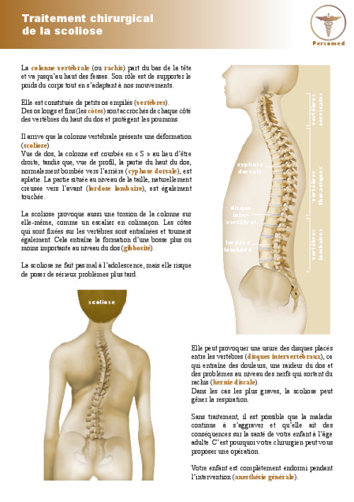 Enfant : Traitement chirurgical de la scoliose