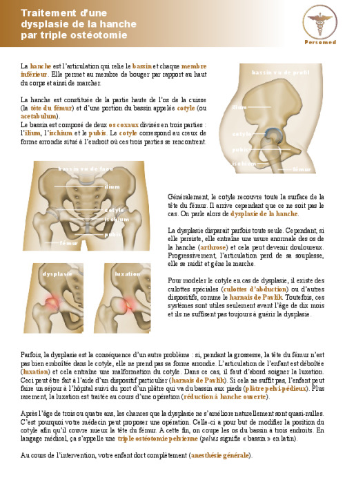Enfant : Traitement d’une dysplasie de la hanche par triple ostéotomie