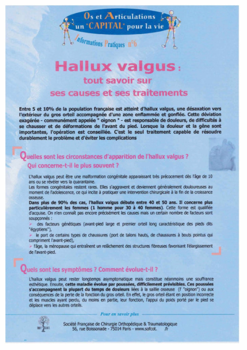 Hallux valgus : tout savoir sur ses causes et ses traitements