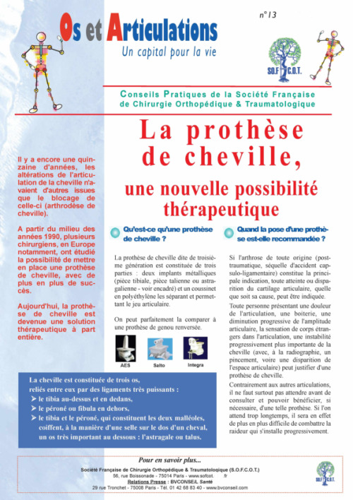 La prothèse de cheville, une nouvelle possibilité thérapeutique