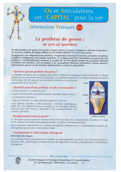 La prothèse de genou : un acte au quotidien