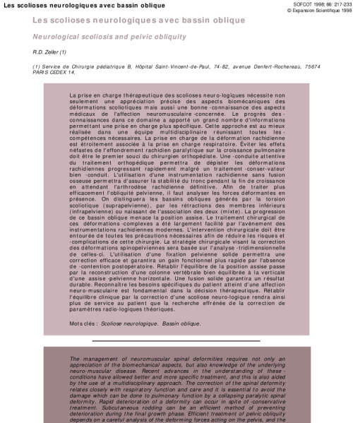 Les scolioses neurologiques avec bassin oblique