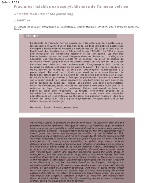 Fractures instables extracotyloidiennes de l’anneau pelvien