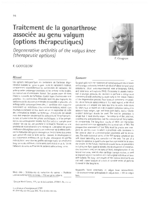 Traitement de la gonarthrose associée au genu valgum (options thérapeutiques)