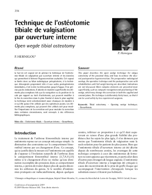 Technique de l’ostéotomie tibiale de valgisation par ouverture interne