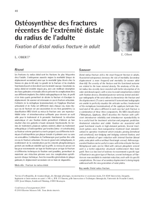 Ostéosynthèse des fractures récentes de l’extrémité distale du radius de l’adulte