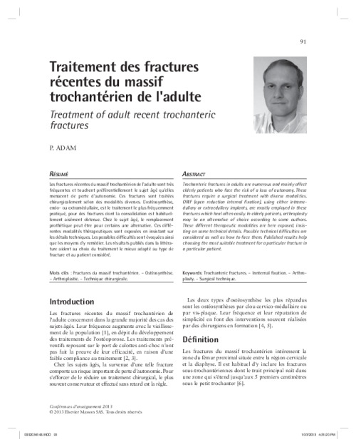 Traitement des fractures récentes du massif trochantérien de l’adulte