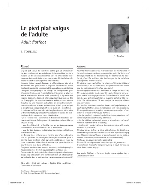 Le pied plat valgus de l'adulte