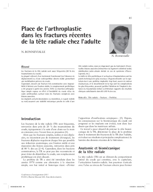 Place de l'arthroplastie dans les fractures récentes de la tête radiale chez l'adulte