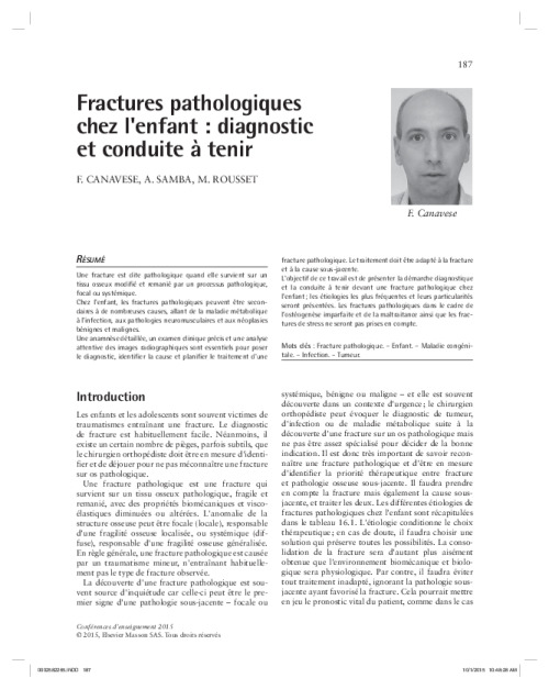 Fractures pathologiques chez l'enfant : diagnostic et conduite à tenir