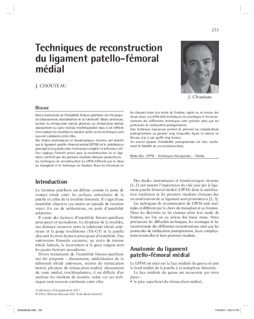 Techniques de reconstruction du ligament patello-fémoral médial