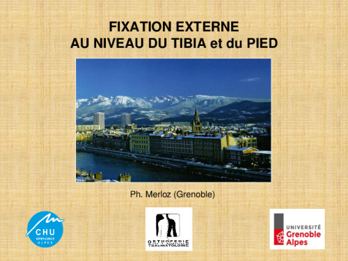 cours de Tours 2017 : traitement des fractures - 5