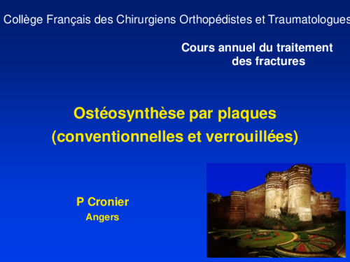cours de Tours 2017 : traitement des fractures - 19