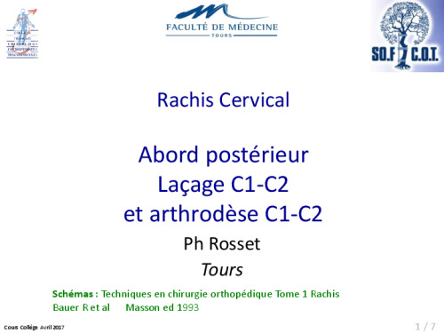 cours de Tours 2017 : traitement des fractures - 21