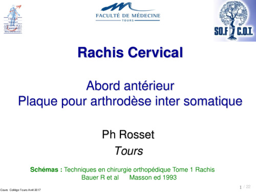 cours de Tours 2017 : traitement des fractures - 23