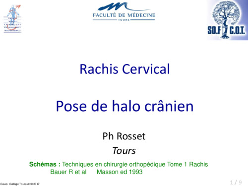 cours de Tours 2017 : traitement des fractures - 24